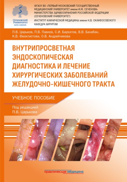 Скачать книгу Внутрипросветная эндоскопическая диагностика и лечение хирургических заболеваний желудочно-кишечного тракта