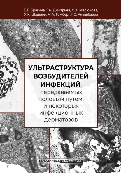 Скачать книгу Ультраструктура возбудителей инфекций, передаваемых половым путем, и некоторых инфекционных дерматозов