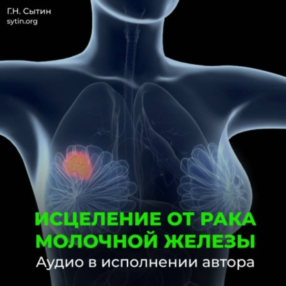 Скачать книгу Рак молочной железы