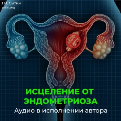Скачать книгу Исцеление от эндометриоза