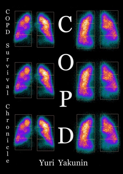 Скачать книгу COPD