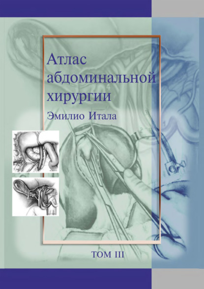 Скачать книгу Атлас абдоминальной хирургии. Том 3. Хирургия тонкой и толстой кишки, прямой кишки и анальной области