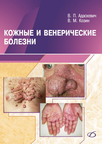 Скачать книгу Кожные и венерические болезни