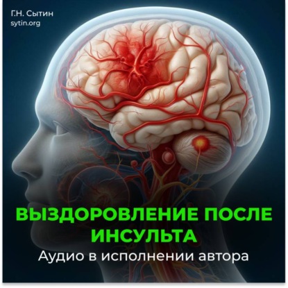 Скачать книгу Выздоровление после инсульта. Все мозговые центры успокаиваются