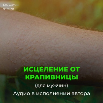 Скачать книгу Исцеление от нейродермита, мужской крапивницы