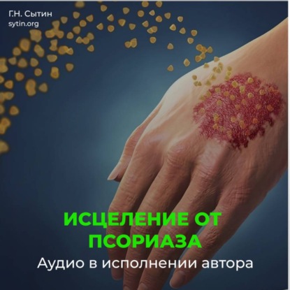Скачать книгу Настрой исцеление от псориаза