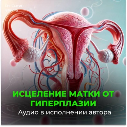 Скачать книгу Исцеление от гиперплазии матки