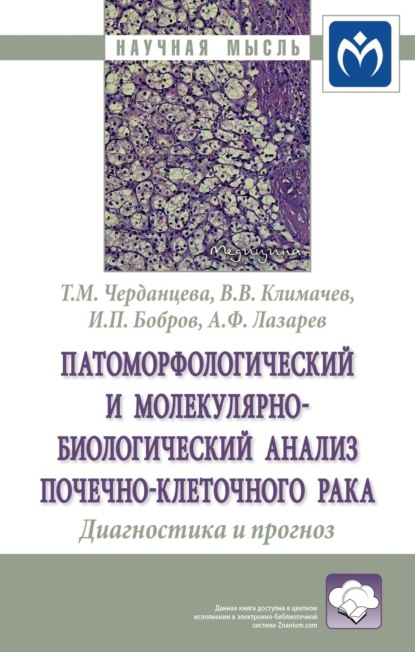 Скачать книгу Патоморфологический и молекулярно-биологический анализ почечно-клеточного рака. Диагностика и прогноз