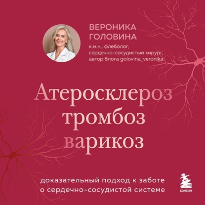 Атеросклероз, тромбоз, варикоз. Доказательный подход к заботе о сердечно-сосудистой системе