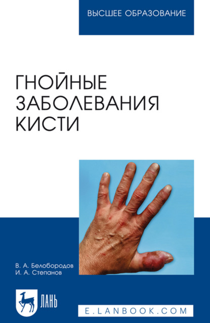 Скачать книгу Гнойные заболевания кисти. Учебное пособие для вузов