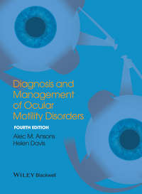 Diagnosis and Management of Ocular Motility Disorders