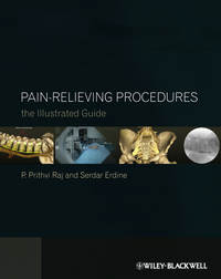 Pain-Relieving Procedures. The Illustrated Guide
