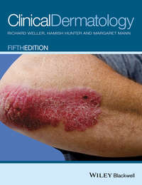 Clinical Dermatology