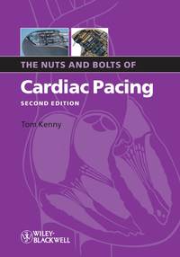 The Nuts and Bolts of Cardiac Pacing