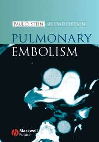 Pulmonary Embolism