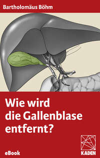 Wie wird die Gallenblase entfernt?