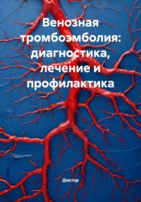 Венозная тромбоэмболия: диагностика, лечение и профилактика