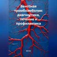 Венозная тромбоэмболия: диагностика, лечение и профилактика
